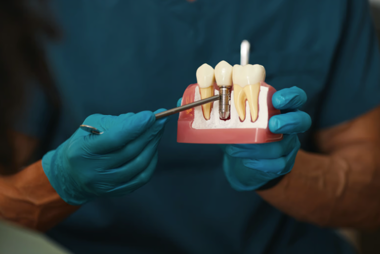 Root Canal Treatment