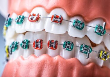 Orthodontics