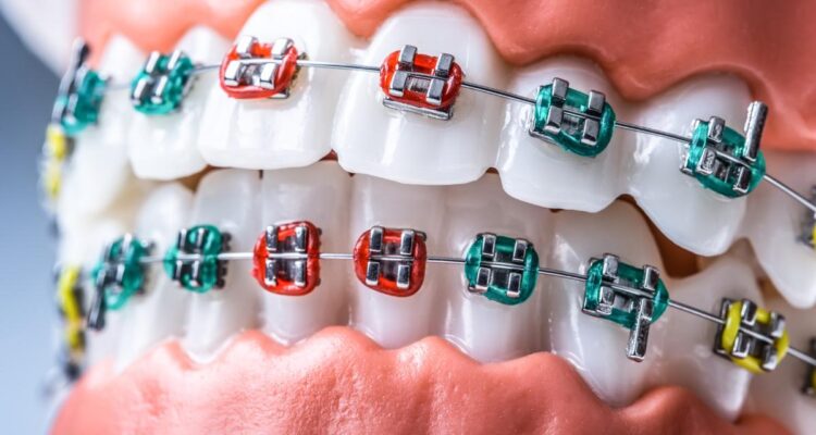 Orthodontics