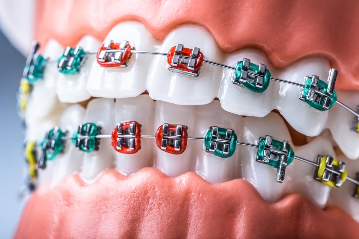 Orthodontics