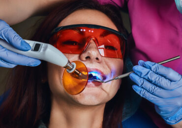 Dental bonding