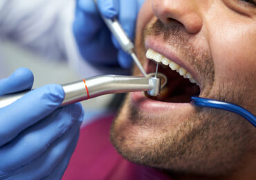 Dental Cleaning