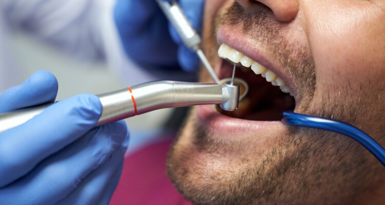 Dental Cleaning