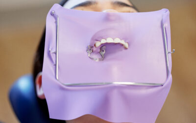 Dental Dam