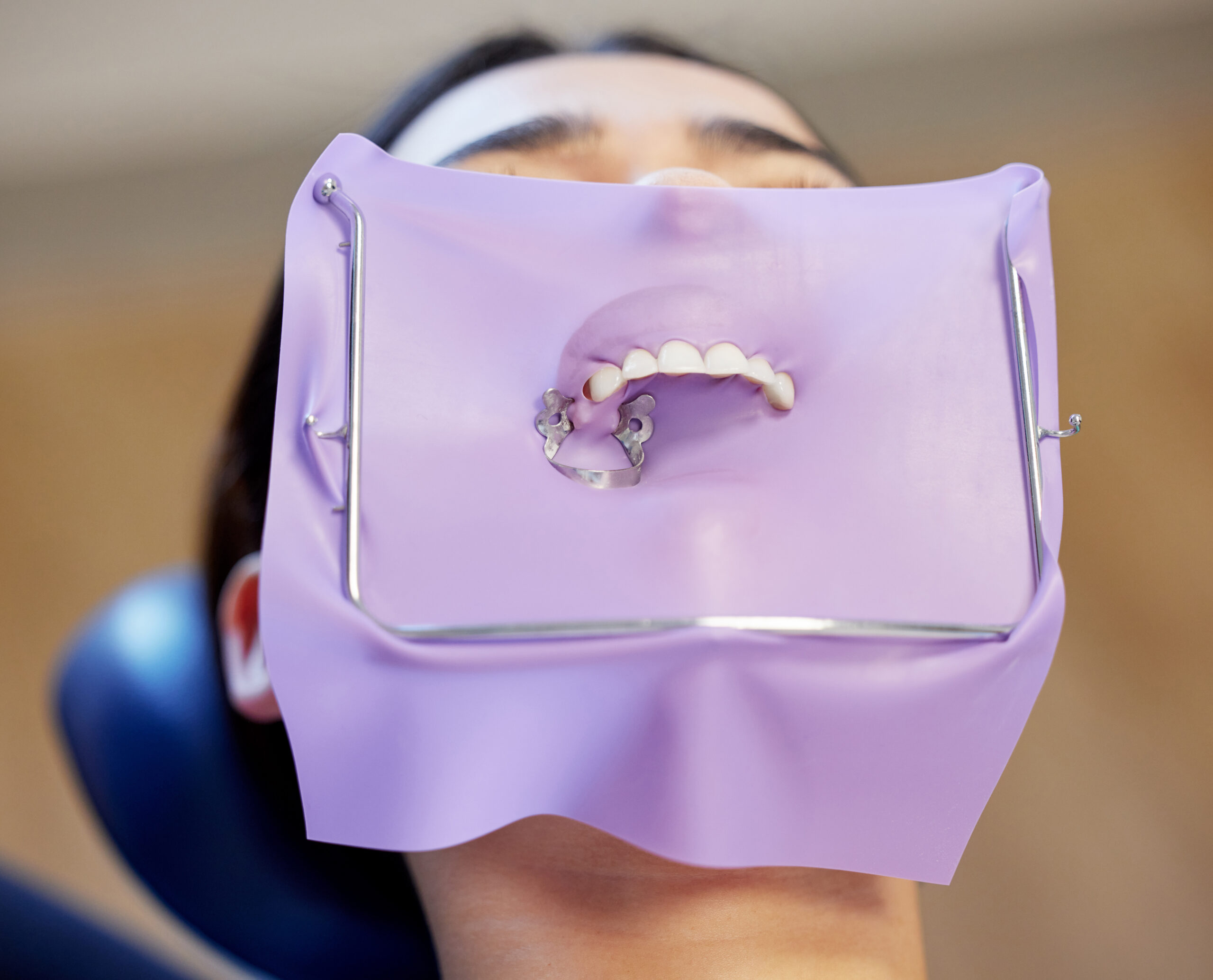Dental Dam