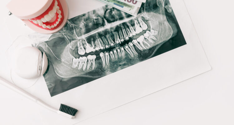 Dental Implant​